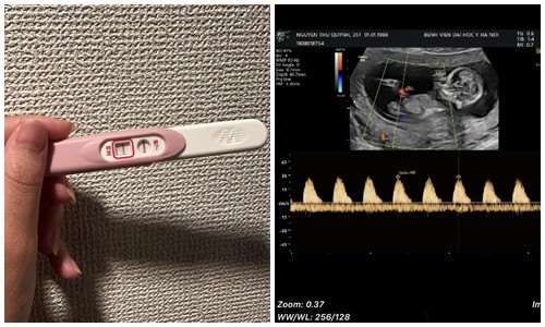 Thu Quynh bat ngo thong bao mang bau lan 2-Hinh-3