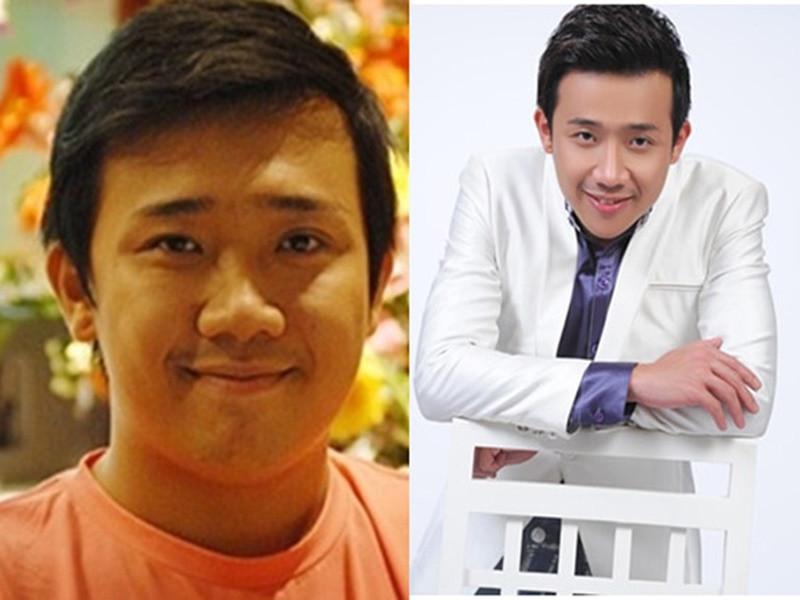 Trấn Thành sửa mũi cách đây nhiều năm. Ảnh: Dân Việt.