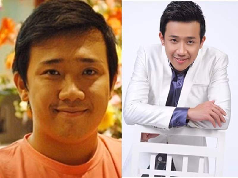 Trấn Thành sửa mũi cách đây nhiều năm. Ảnh: Dân Việt.