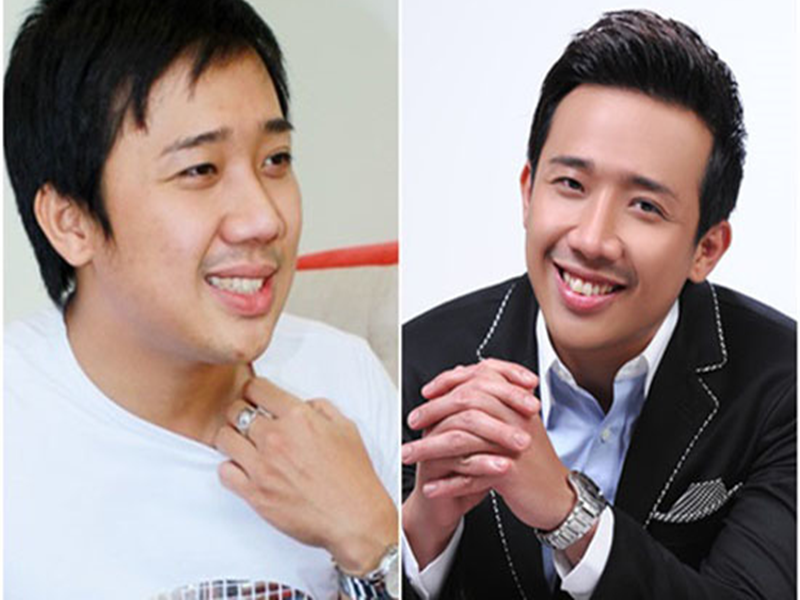 Chiếc mũi của Trấn Thành thon gọn hơn sau khi phẫu thuật thẩm mỹ. Ảnh: Vietnamnet.