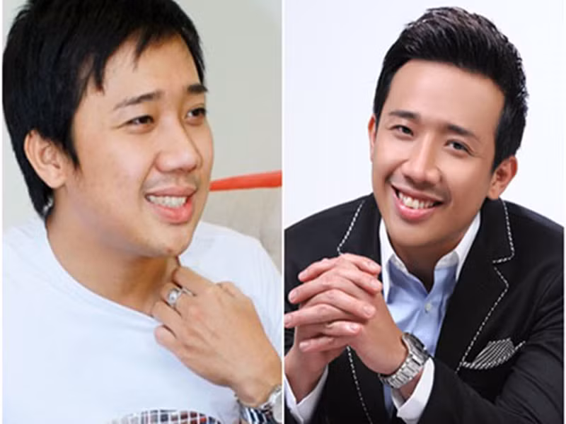 Chiếc mũi của Trấn Thành thon gọn hơn sau khi phẫu thuật thẩm mỹ. Ảnh: Vietnamnet.