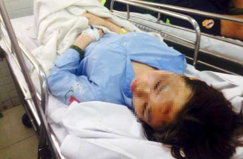 Hương bị bỏng nặng, mắt trái không thể hồi phục, tiên lượng mù.