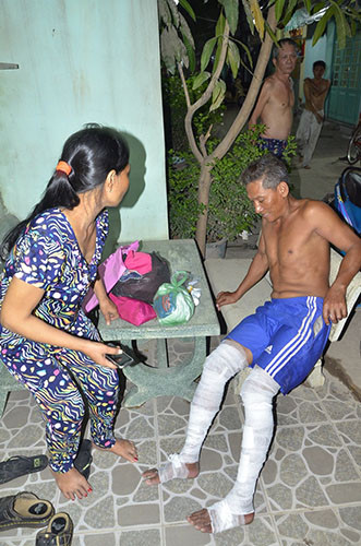 No khi gas, hai nguoi bi bong nang-Hinh-2