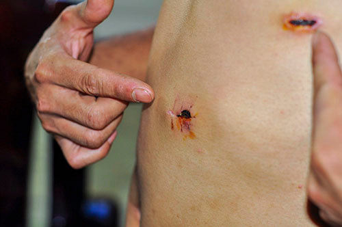 Lam ro pho cong an xa no sung cao su vao dan-Hinh-2