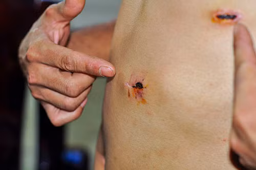 Lam ro pho cong an xa no sung cao su vao dan-Hinh-2