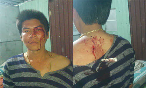 Con re to bi nguoi nha vo hanh hung da man o Binh Duong