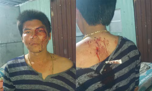 Con re to bi nguoi nha vo hanh hung da man o Binh Duong