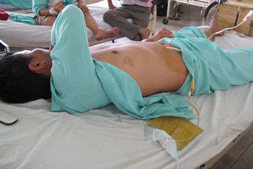 Tiet lo cuoc song vo chong sau cac vu cat 