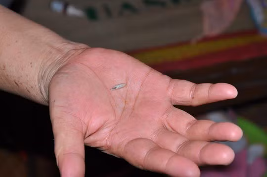 Kinh hai phat hien gioi trong tai tre so sinh-Hinh-2