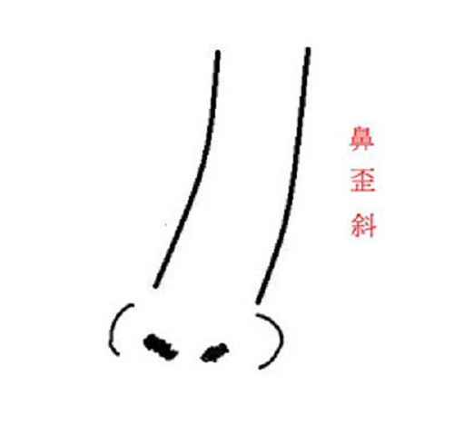 Nữ giới mà mũi có nốt ruồi đen hoặc xám thường lấy được người chồng chăm chỉ. Tuy nhiên, chồng lại hay ốm yếu, bệnh tật.