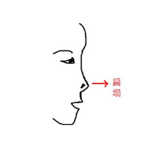 Phụ nữ có mũi lệch thường không chung thủy trong hôn nhân. Họ dễ ly hôn rồi lại kết hôn nhiều lần trong đời.