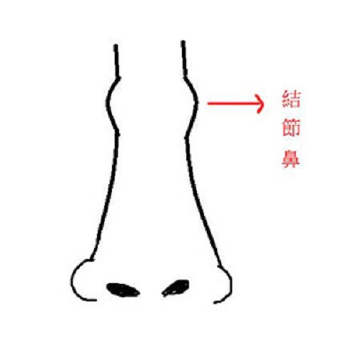 Mũi có nhiều nốt nhỏ thường là phụ nữ cứng đầu. Khi lấy chồng, nhiều khả năng họ phải làm lẽ.