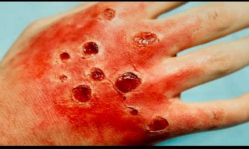 Những căn bệnh giết chết bạn trong chỉ một ngày.