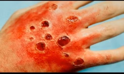 Những căn bệnh giết chết bạn trong chỉ một ngày.