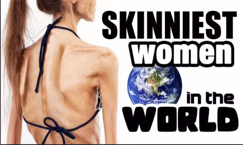 Người phụ nữ gầy nhất thế giới.