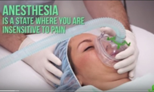 Thuốc gây mê tác động lên não của bạn.