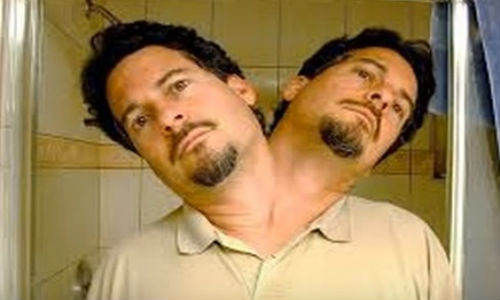 Kỳ lạ người đàn ông có hai đầu.