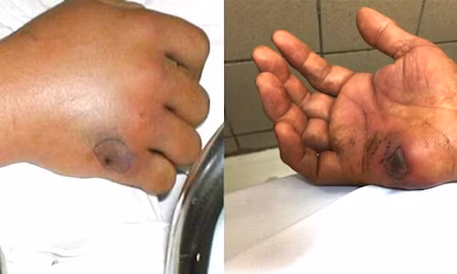 Ly do khien ngay nao cung co nguoi bi ran can