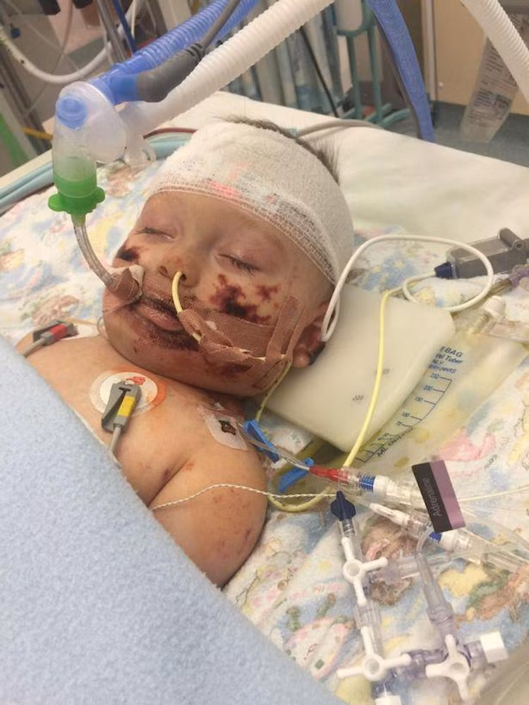 Tuy vậy Taylor đã trở thành “chiến binh nhí” thực thụ khi chiến thắng lưỡi hái của tử thần. Sau một loạt các liệu trình điều trị, bác sĩ đã phải phẫu thuật cắt bỏ toàn bộ các ngón tay và chân trái để cứu tính mạng của Taylor.