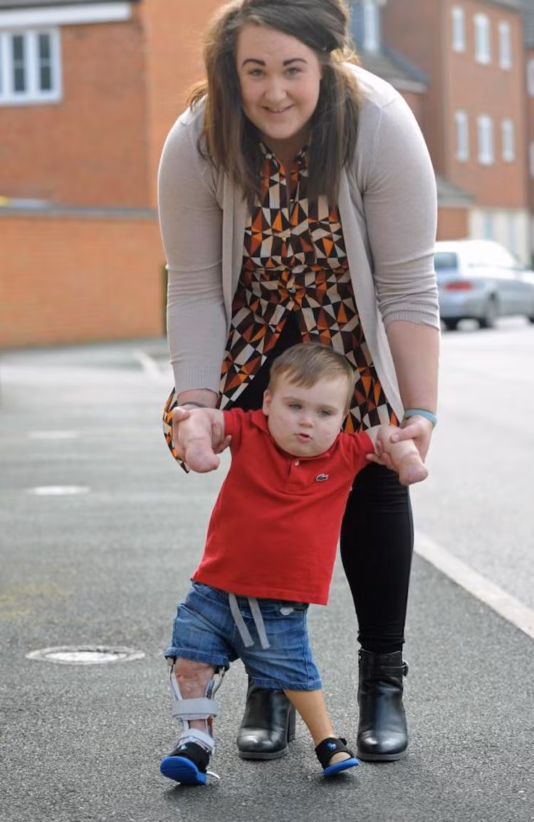 Rất nhiều nhà hảo tâm đã đóng góp ủng hộ cho gia đình Taylor để em có thể nhận được điều trị y tế tốt nhất. “Thiên thần mỉm cười” Taylor vẫn luôn lạc quan như ngày nào, hy vọng em sẽ có một cuộc sống mạnh khỏe và hạnh phúc.