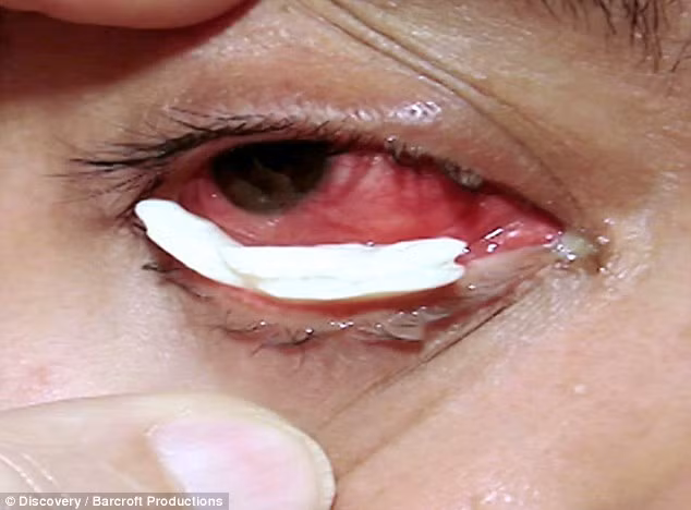 Nguoi phu nu dau dón vì khoc ra nuóc mát pha le