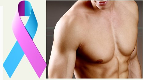 U cục xung quanh núm vú có thể là dấu hiệu của ung thư vú. Thông thường, nam giới ngực không phát triển mạnh như phụ nữ. Đàn ông khi thường xuyên vận động, tập thể hình sẽ làm cho ngực nở hơn người bình thường. Nếu phát triển đều đặn cả hai bên thì không có gì đáng lo ngại. Nhưng nếu một bên vú có sự phát triển bất thường, khu vực vú có khối u nhô hẳn ra hoặc có thể sờ thấy thì có khả năng là mắc ung thư vú.