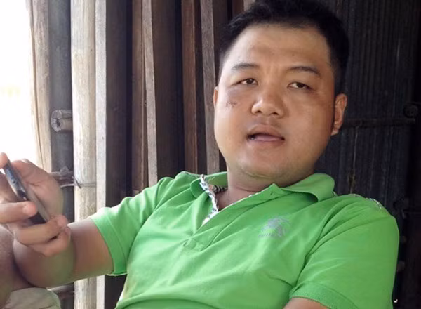 Vu chim tau kinh hoang nhat Ca Mau: noi dau nguoi o lai-Hinh-2