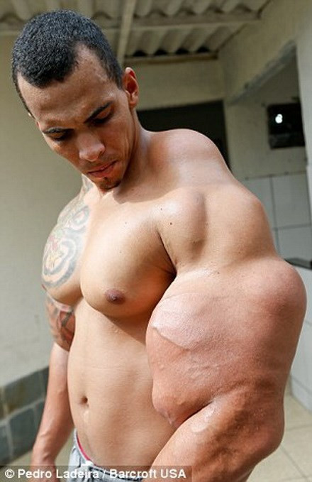 Alves cho biết anh rất hâm mộ nhân vật Người khổng lồ xanh. 