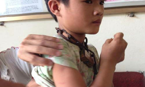 Nghe An: Be trai bi xich co di lang thang khap noi