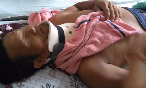 Vo troi chong vao goc cay danh dap da man o Long An