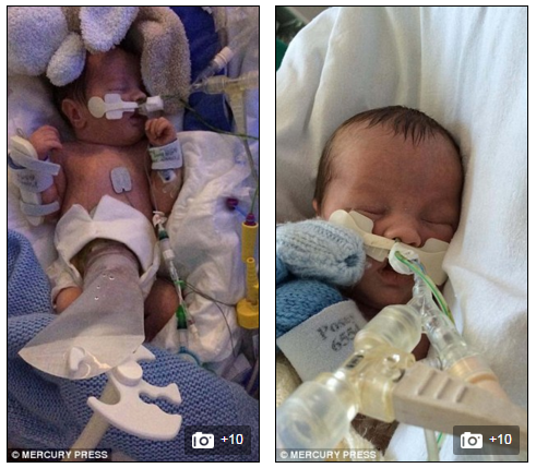 Frankie được giữ lại trong bệnh viện suốt nhiều tháng sau khi sinh để điều trị. 