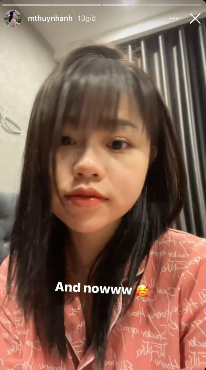 Cô nàng cũng đính kèm gương mặt ở thời điểm hiện tại với làn da trắng trẻo không tì vết để thông báo làn da của mình đã đỡ hơn rất nhiều, và trông xinh tươi hẳn ra.