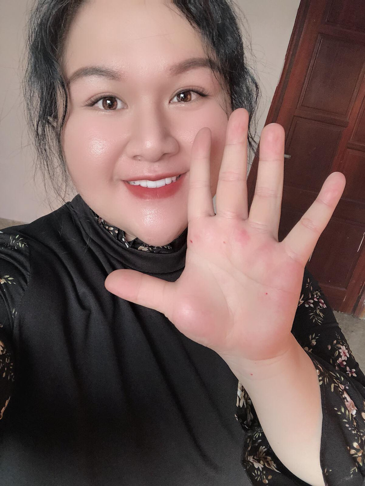 Được biết “hot girl trăm ký” từng trải qua 2 lần đại phẫu và 1 lần tiểu phẫu để hút mỡ, tạo hình bụng và bóc mỡ má để có được sắc vóc như ngày hôm nay.