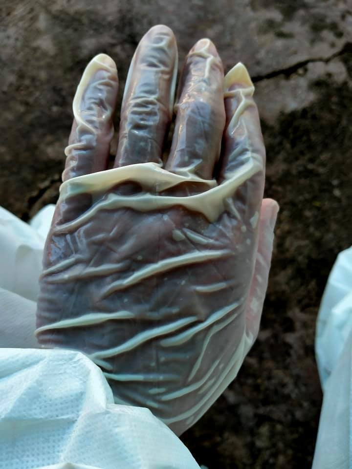 Bình thường họ phải mặc quần áo bảo hộ, đeo khẩu trang, kính che giọt bắn, mồ hôi chảy khiến nhiều người rơi vào cảnh mất nước, ngất khi làm việc.