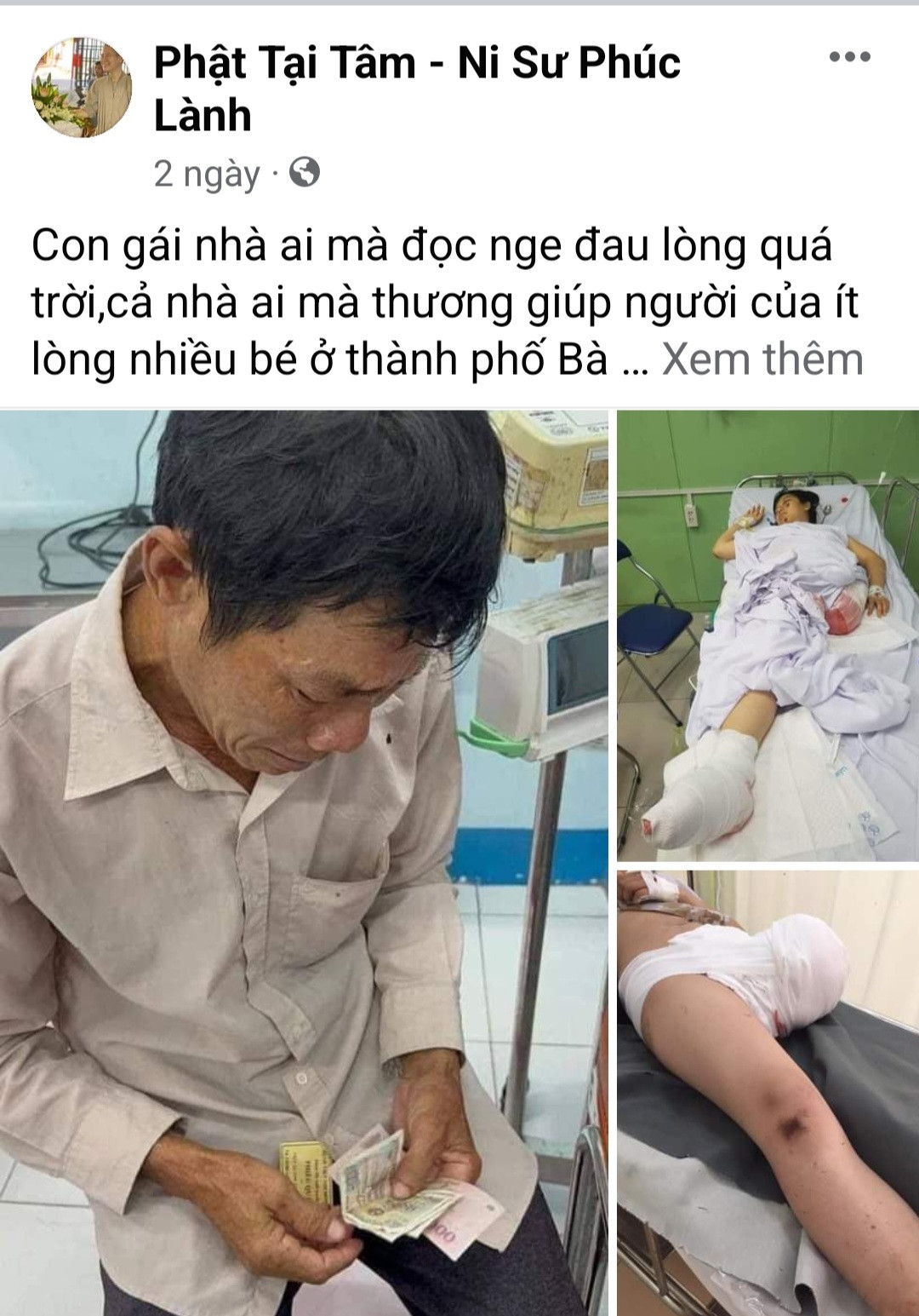 Dung anh co gai bi tai nan giao thong de keu goi tu thien