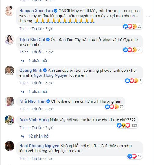 Hong Ngoc cong khai anh mat bien dang vi bong, ai cung xot xa-Hinh-3