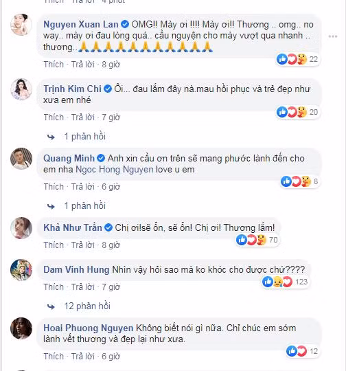 Hong Ngoc cong khai anh mat bien dang vi bong, ai cung xot xa-Hinh-3