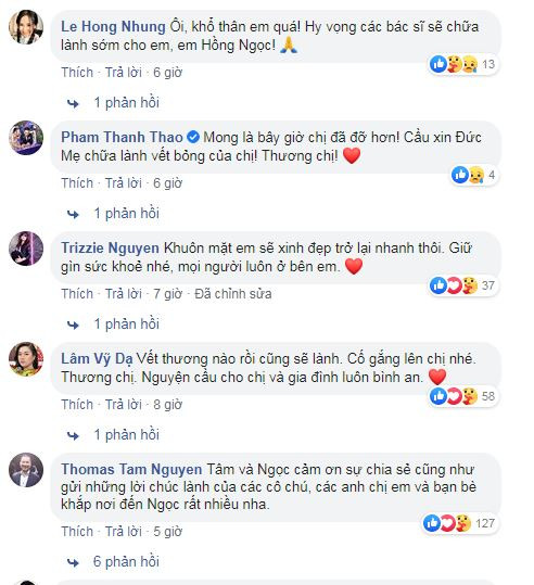 Hong Ngoc cong khai anh mat bien dang vi bong, ai cung xot xa-Hinh-2