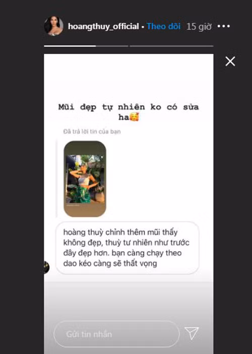 Hoàng Thùy lên tiếng khẳng định mũi của cô đẹp tự nhiên.