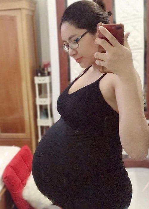 Vì mang song thai nên Thu Thảo bị rạn da khá nhiều.