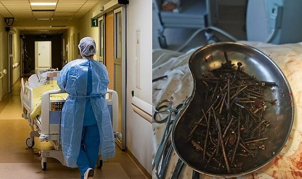 Choang: Nguoi dan ong nuot 1kg dinh vit vao bung!