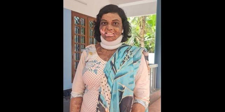 Ngu gat khi on bai, nguoi phu nu nga vao den dau, bong 50%