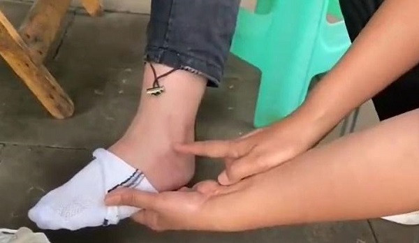 Bi giao vien phat squat 150 lan, nu sinh tan tat vinh vien