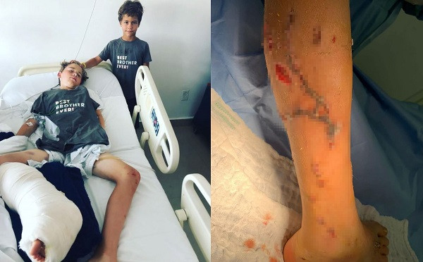 Choi tron tim, cau be bi ca sau “phuc kich”, suyt ngoam mat chan-Hinh-2