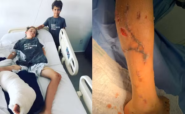 Choi tron tim, cau be bi ca sau “phuc kich”, suyt ngoam mat chan-Hinh-2