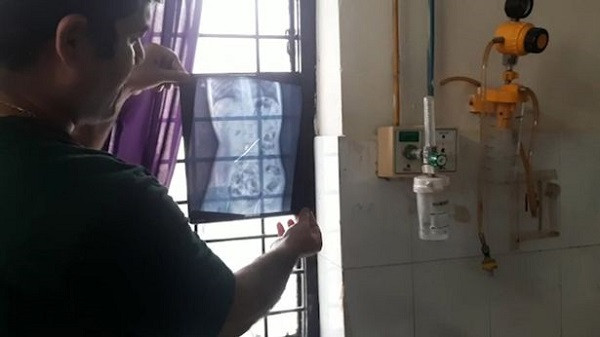 Cau be nuot ban chai va dinh sat de chua chung nghien an dat