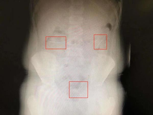 Cau be nuot kim vao bung vi muon lam... ao thuat gia