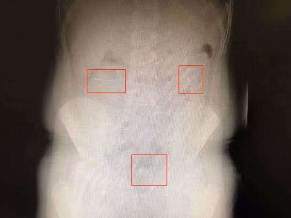 Cau be nuot kim vao bung vi muon lam... ao thuat gia