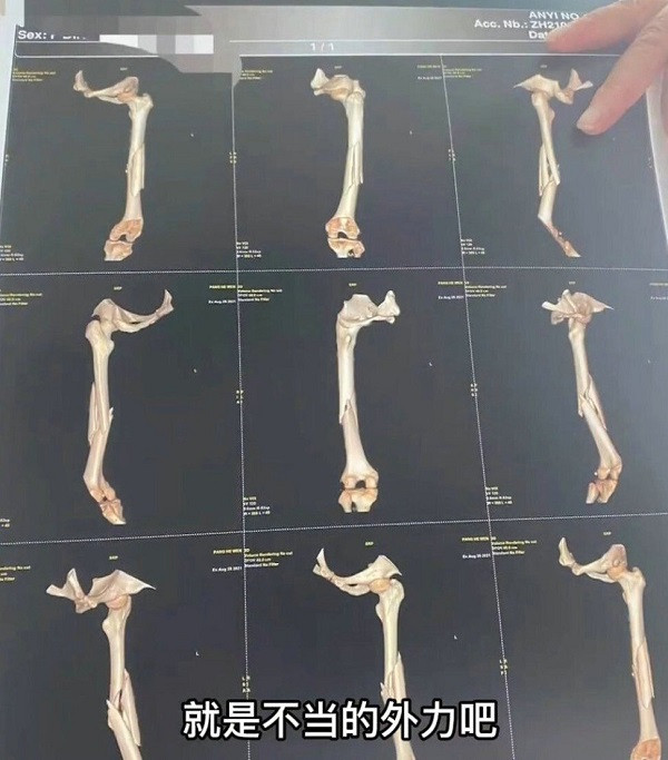 Giao vien yoga be gay xuong dui cua hoc vien trong luc day-Hinh-3