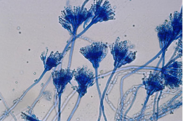 Bên cạnh đó, các loại gia vị (Hạt tiêu đen, nghệ, ớt, rau mùi, gừng) và các loại quả hoặc hạt khác như hạt dẻ, dừa…cũng có thể bị nhiễm độc tố Aflatoxin. Ảnh: daihocduochanoi.